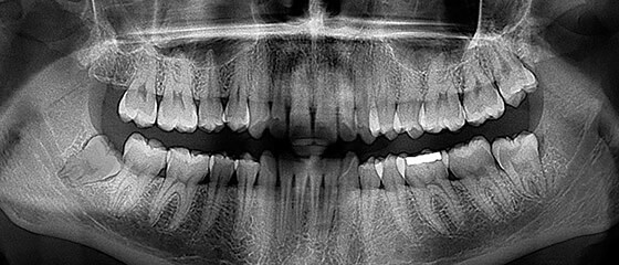 Cirugía Bucal y Maxilofacial