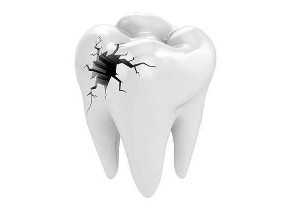 Control de Infecciones