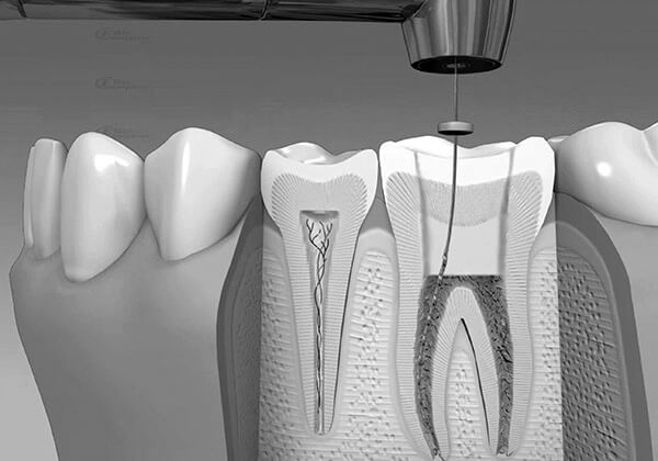 Control de Infecciones
