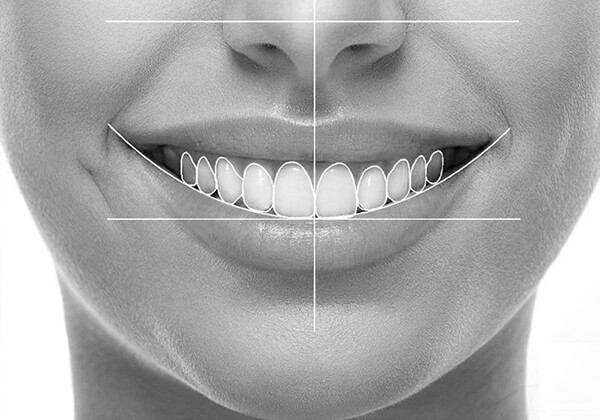 Diseño Digital de la Sonrisa