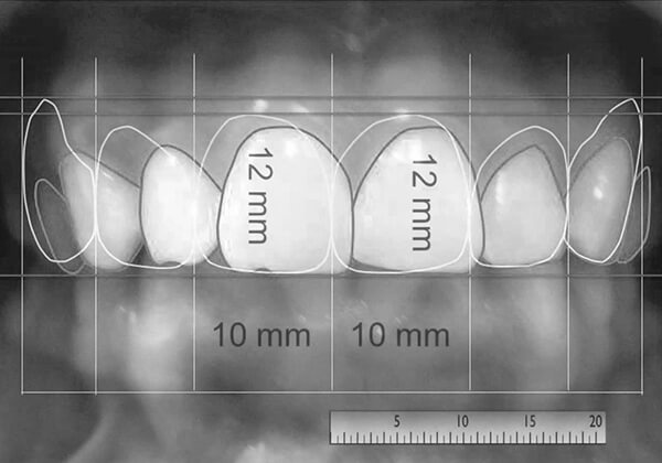Diseño Digital de la Sonrisa